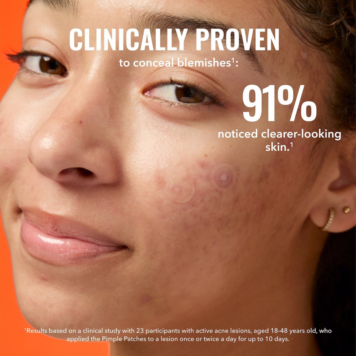 pimple-patches-u8 zb_p.jpg